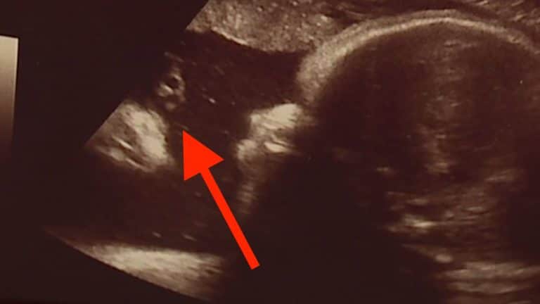 Did Jesus show up in this couple’s sonogram?